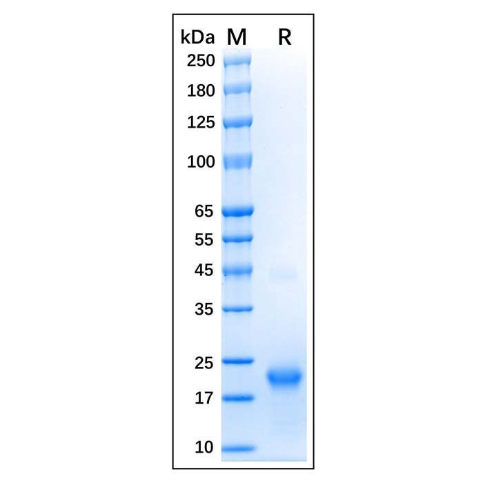 Recombinant Human GTPase HRAS Protein -    by Aladdin Scientific