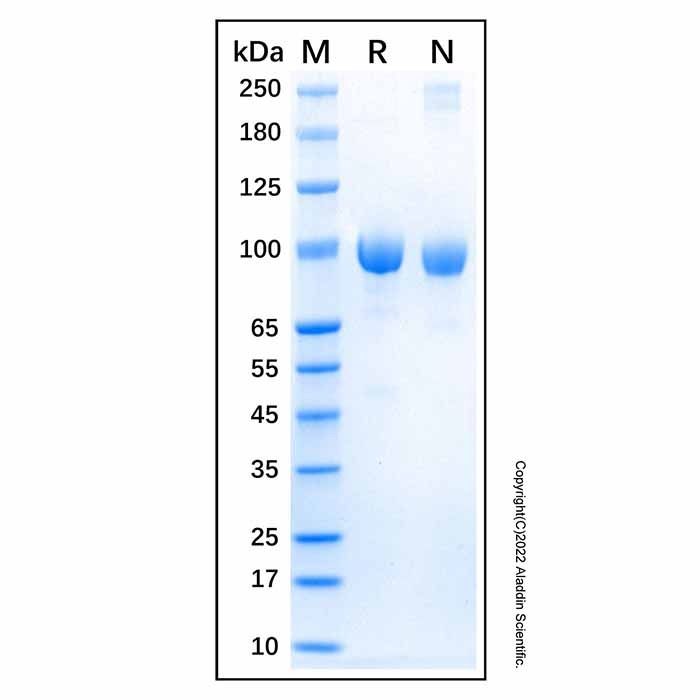 Recombinant Human FAP Protein -    by Aladdin Scientific