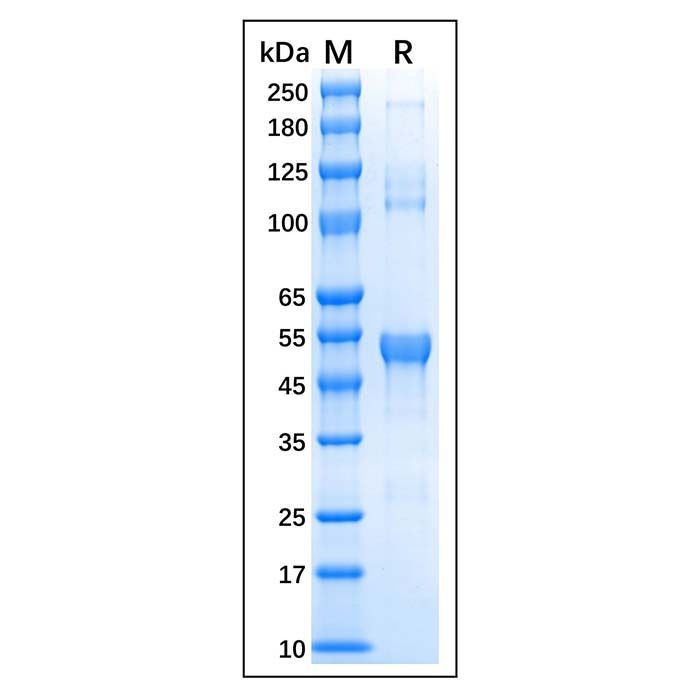 Recombinant Human c-Fos Protein -    by Aladdin Scientific