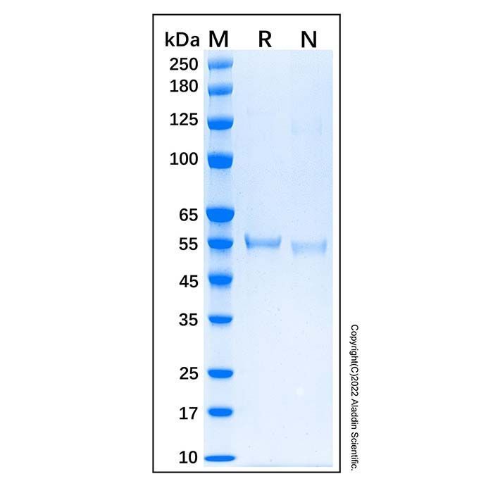 Recombinant Human p53 Protein -    by Aladdin Scientific
