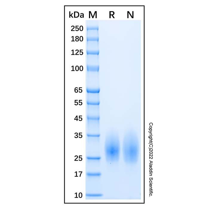 Recombinant Human IL-22 Protein -    by Aladdin Scientific