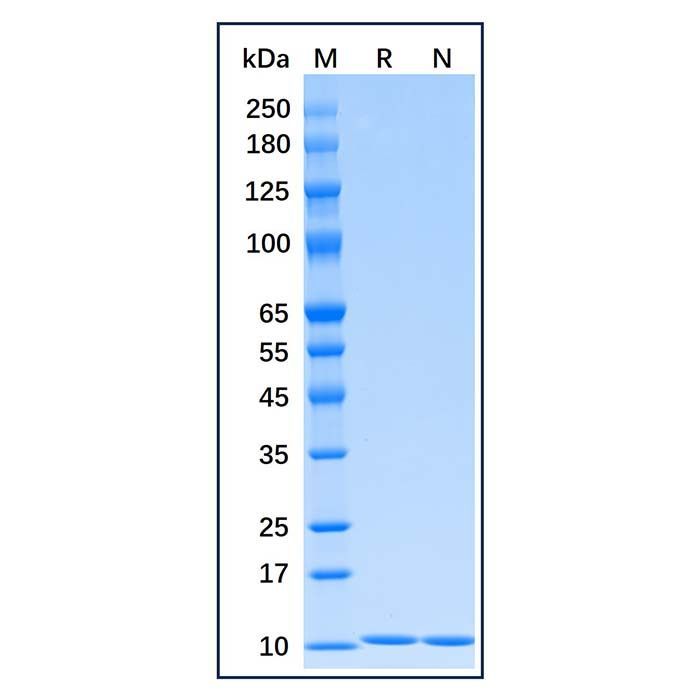 Recombinant Human HA-Ubiquitin Protein -    by Aladdin Scientific