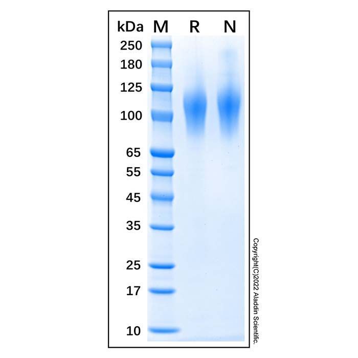 Recombinant Human CD68 Protein -    by Aladdin Scientific