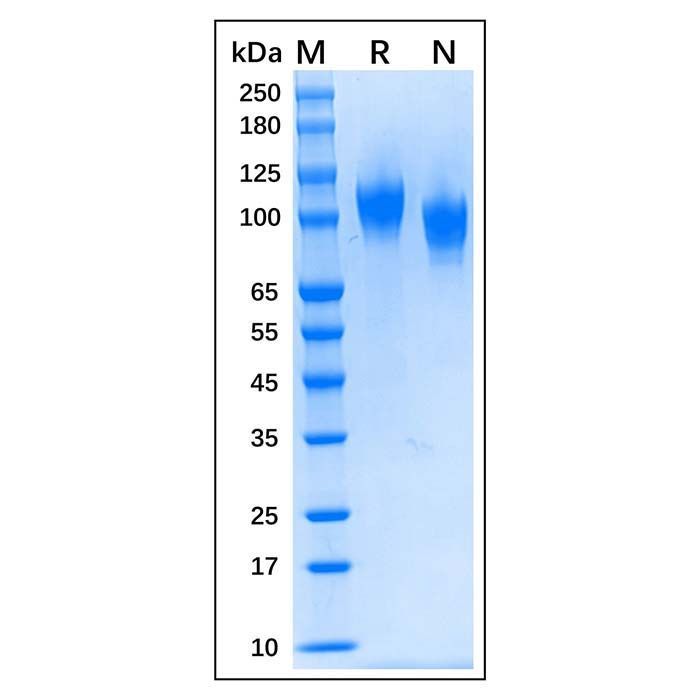 Recombinant Human NCAM-1/CD56 Protein -    by Aladdin Scientific