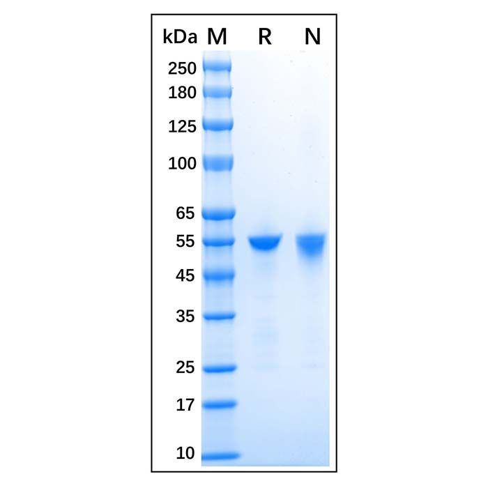 Recombinant Human ALDH1A1 Protein -    by Aladdin Scientific