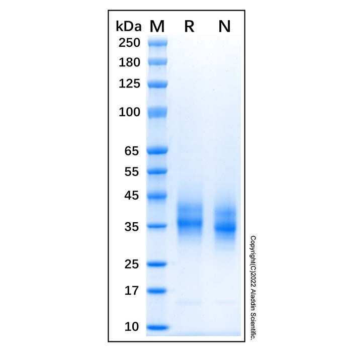 Recombinant Canine CD64 Protein -    by Aladdin Scientific