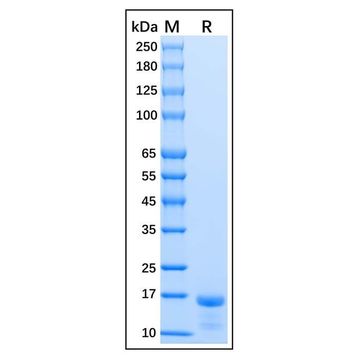 Recombinant Human Survivin Protein -    by Aladdin Scientific