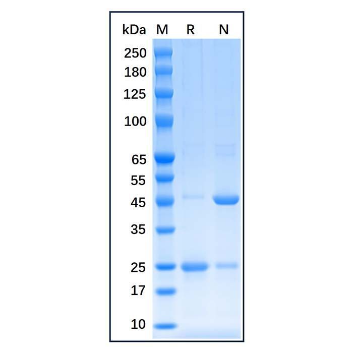 Recombinant Human Estrogen Receptor alpha Protein -    by Aladdin Scientific