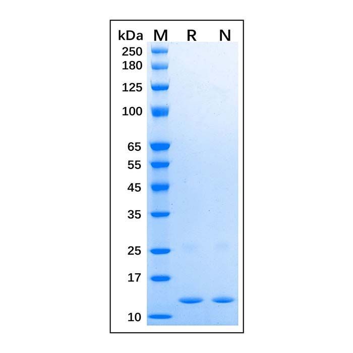 Recombinant Human SAA1 Protein -    by Aladdin Scientific