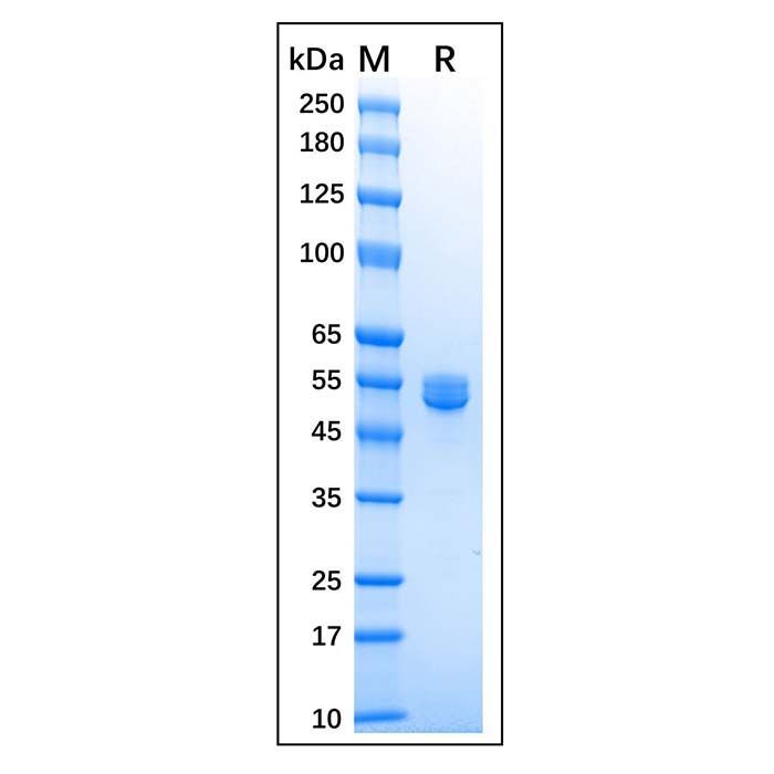 Recombinant Human MMP-1 Protein -    by Aladdin Scientific
