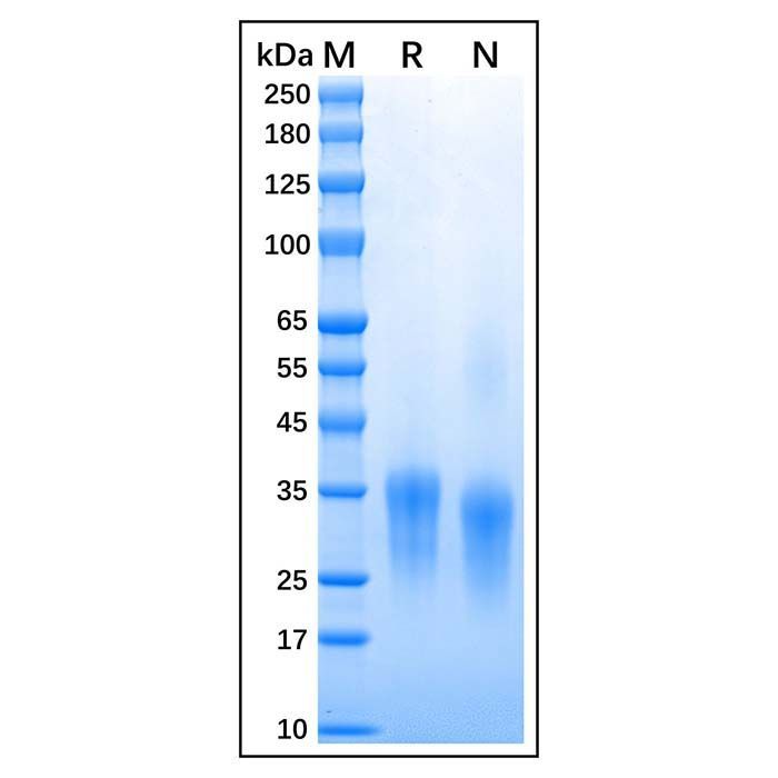 Recombinant Feline CD8 alpha Protein -    by Aladdin Scientific
