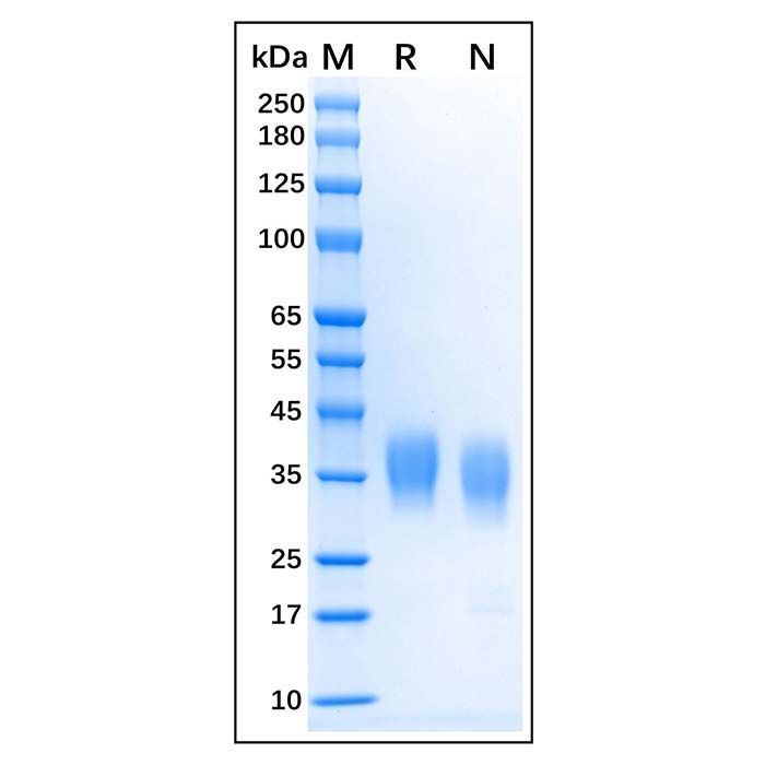 Recombinant Bovine CD16 Protein -    by Aladdin Scientific