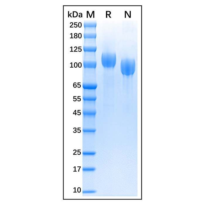 Recombinant Bovine CD56 Protein -    by Aladdin Scientific
