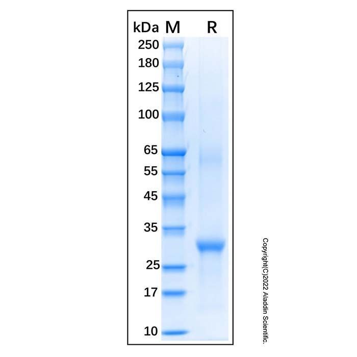 Recombinant Feline CD19 Protein -    by Aladdin Scientific