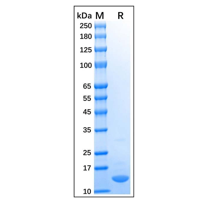 Recombinant Human COX2 Protein -    by Aladdin Scientific