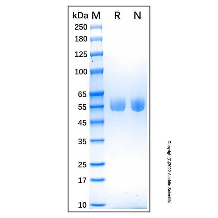 Recombinant Human Serpin A1/alpha-1-Antitrypsin Protein -    by Aladdin Scientific