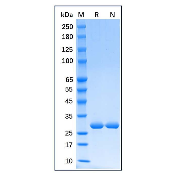 Recombinant Human Heme Oxygenase 1 Protein -    by Aladdin Scientific