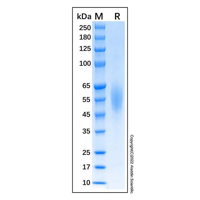 Recombinant Human CD200R1 Protein -    by Aladdin Scientific