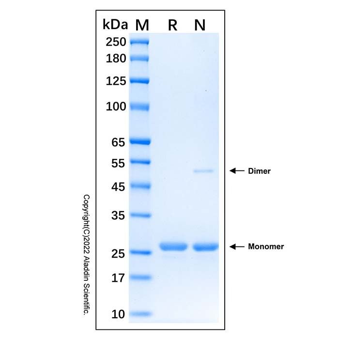 Recombinant Human SENP2 Protein -    by Aladdin Scientific