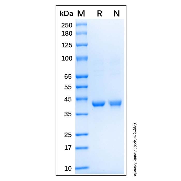 Recombinant Human IDO Protein -    by Aladdin Scientific