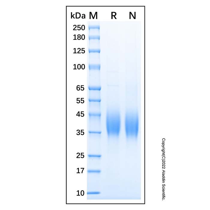 Recombinant Human SLAMF7/CRACC Protein -    by Aladdin Scientific