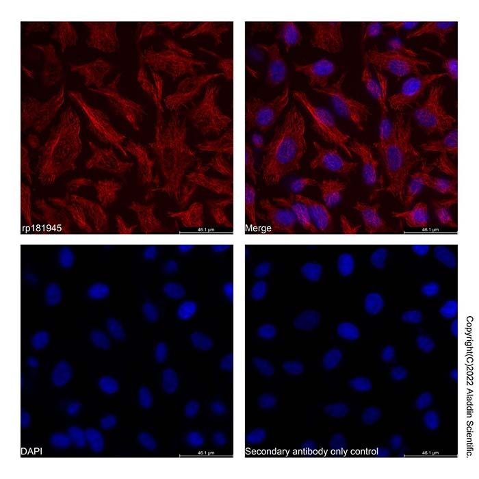 Recombinant Streptavidin Protein (AF594) -    by Aladdin Scientific