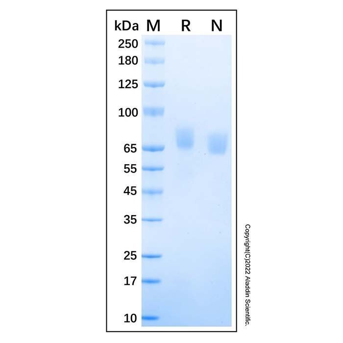 Recombinant Human ALCAM/CD166 Protein -    by Aladdin Scientific