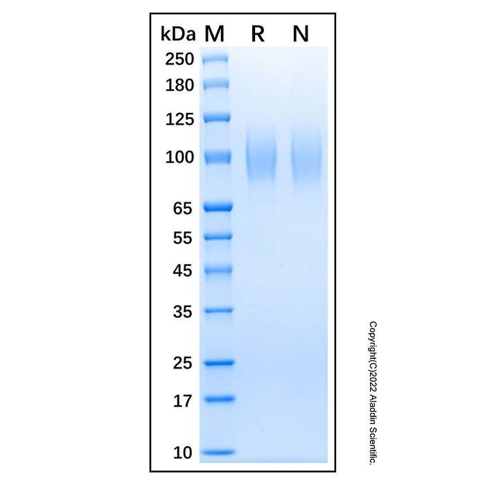 Proteína humana recombinante gp130 -    by Aladdin Scientific