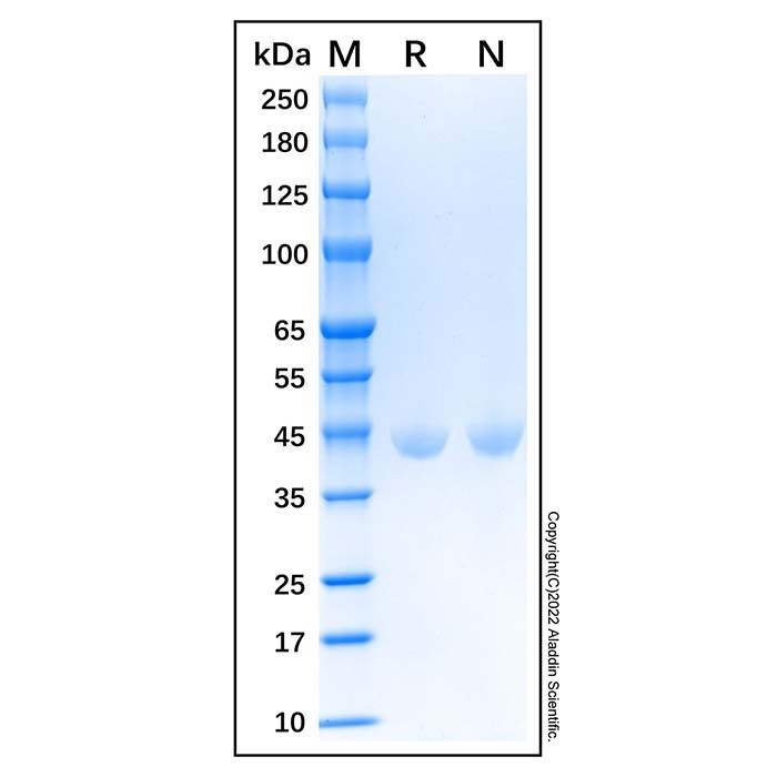 Recombinant Human Creatine Kinase BB Protein -    by Aladdin Scientific