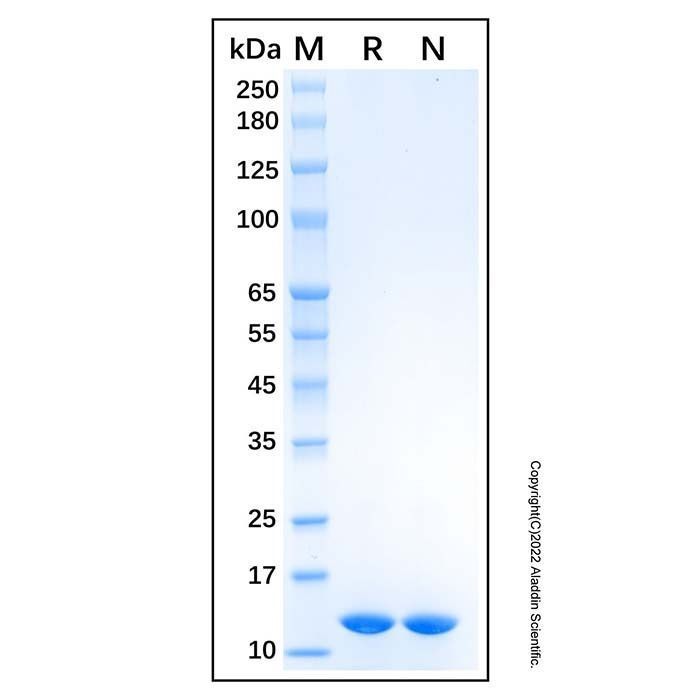 Recombinant Human Cystatin A Protein -    by Aladdin Scientific
