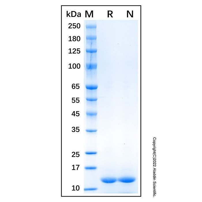 Recombinant Human FABP1/L-FABP Protein -    by Aladdin Scientific