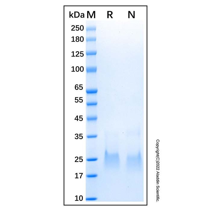 Recombinant Human GGCT Protein -    by Aladdin Scientific