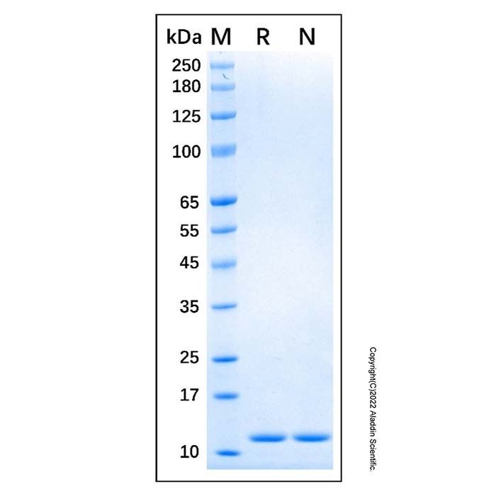 Recombinant Human S100A4 Protein -    by Aladdin Scientific