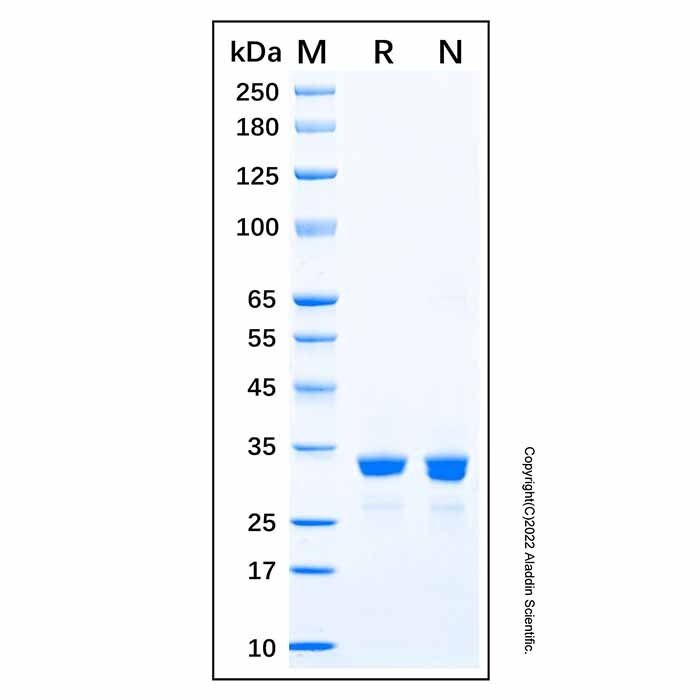 Recombinant Human SULT1B1 Protein -    by Aladdin Scientific