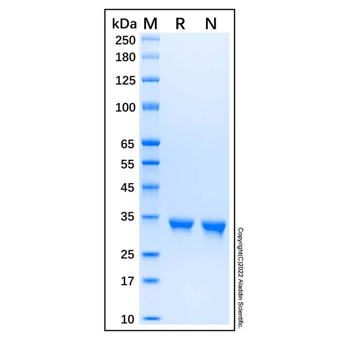 Recombinant Human SULT2A1/ST2 Protein -    by Aladdin Scientific