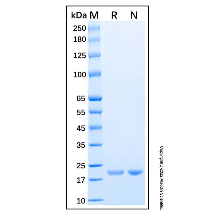 Recombinant Human Ube2H Protein -    by Aladdin Scientific