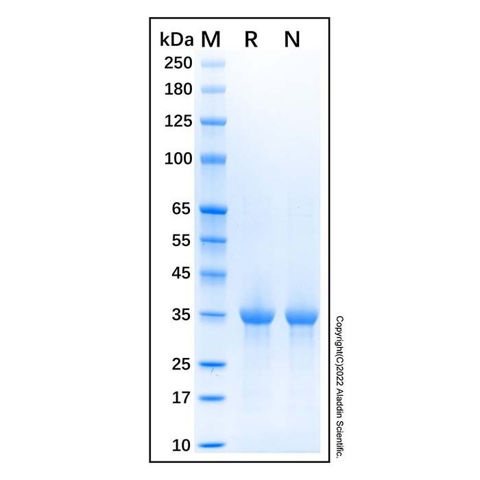 Recombinant Human PARP-1 Protein -    by Aladdin Scientific