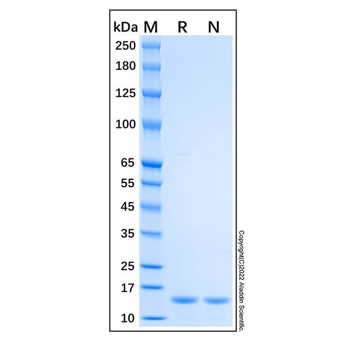 Recombinant Human Profilin 1 Protein -    by Aladdin Scientific