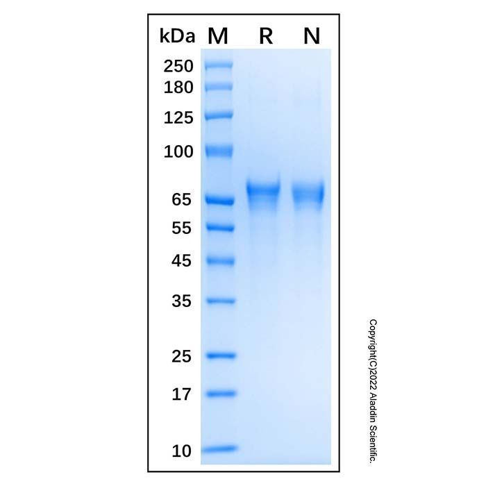Recombinant Human Lamin A Protein -    by Aladdin Scientific