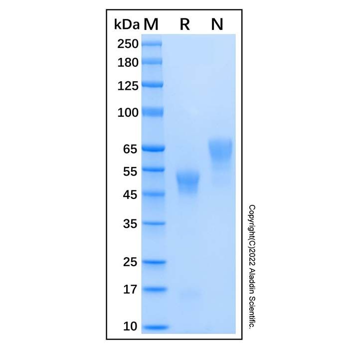 Recombinant Human Coagulation Factor Xa Protein -    by Aladdin Scientific