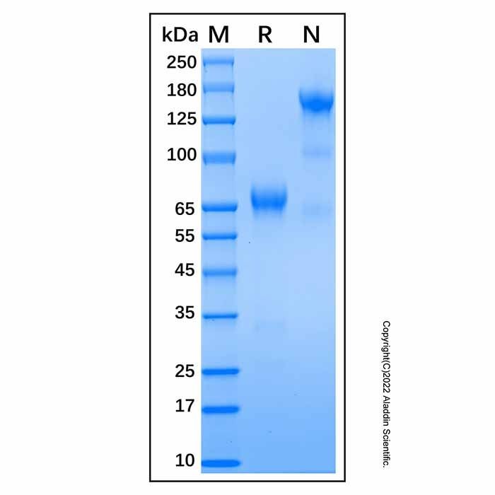 Recombinant Human KIR2DL2/CD158b1 Protein -    by Aladdin Scientific