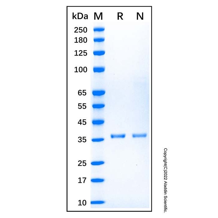 Recombinant Human Cytokeratin 5 Protein -    by Aladdin Scientific