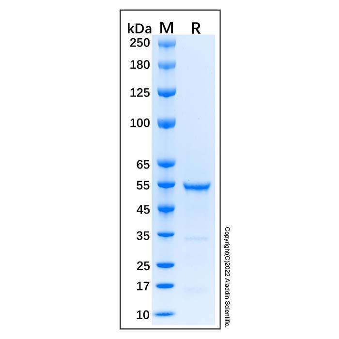Recombinant Human Smad3 Protein -    by Aladdin Scientific
