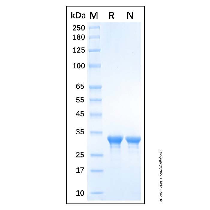 Recombinant Human HMGN1 Protein -    by Aladdin Scientific