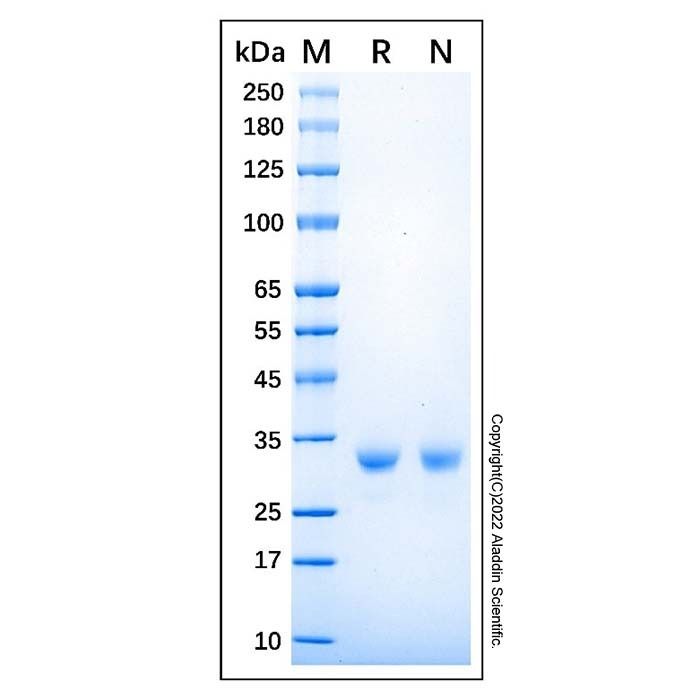 Recombinant Human Histamine N-Methyltransferase/HNMT Protein -    by Aladdin Scientific