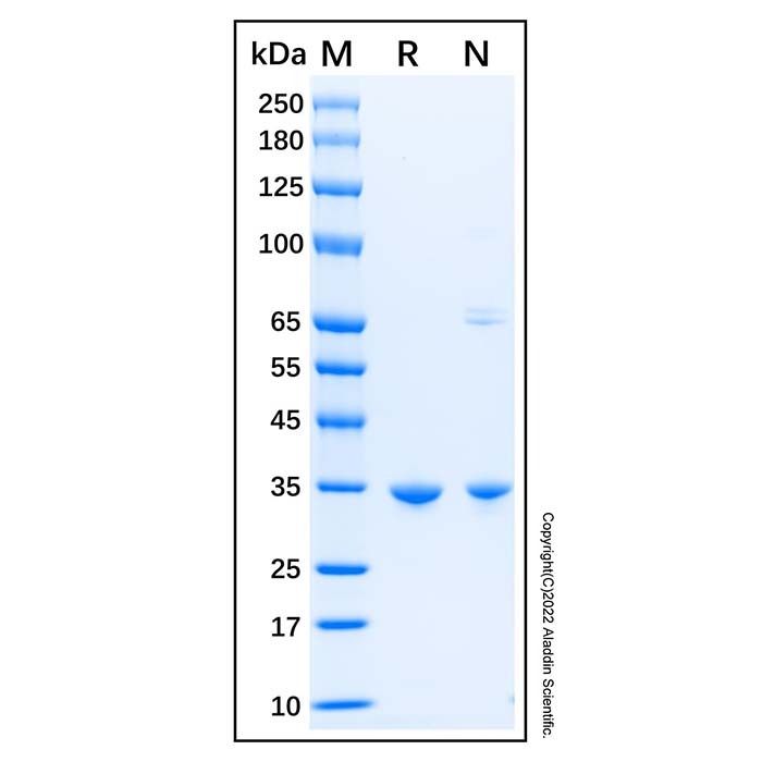 Recombinant Human SULT1A3 Protein -    by Aladdin Scientific