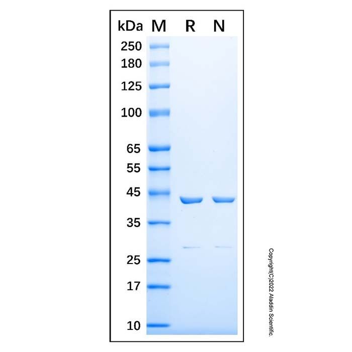 Recombinant Human LRPAP1 Protein -    by Aladdin Scientific