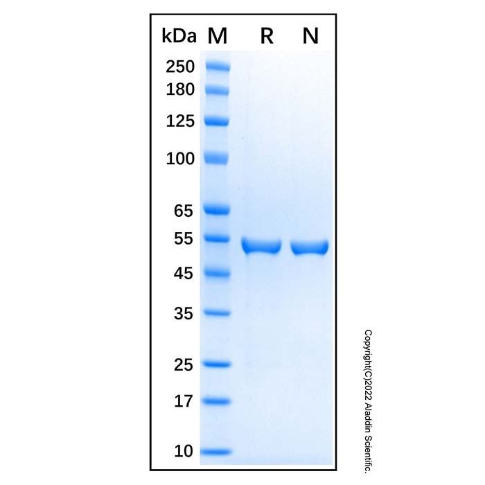 Recombinant Human Cytokeratin 8 Protein -    by Aladdin Scientific