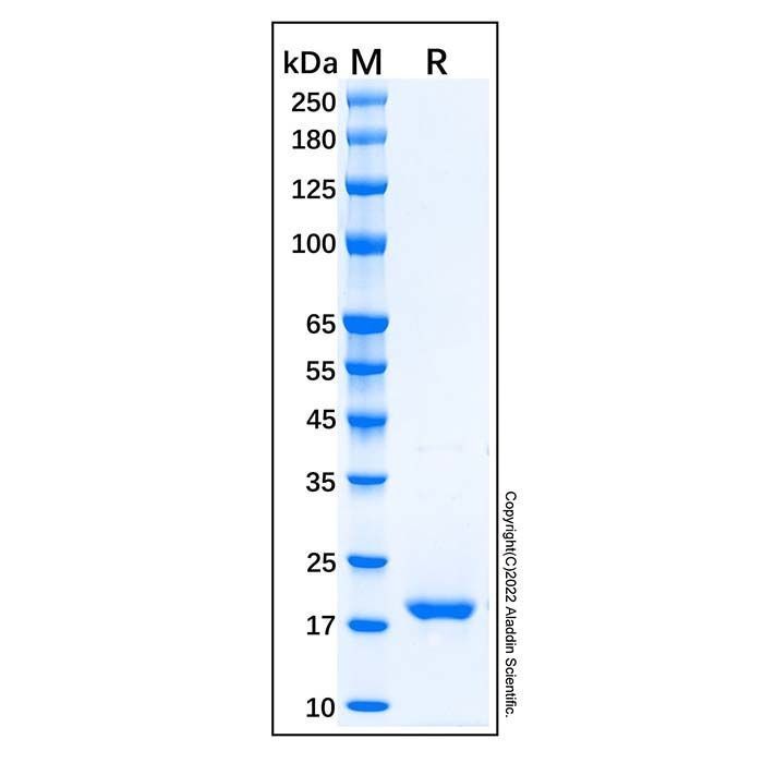 Recombinant Human TRAIL/TNFSF10 Protein -    by Aladdin Scientific