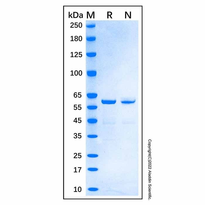 Recombinant Human Catalase Protein -    by Aladdin Scientific